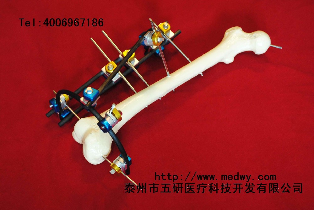 Patients with fracture, arthritis and limb deformity