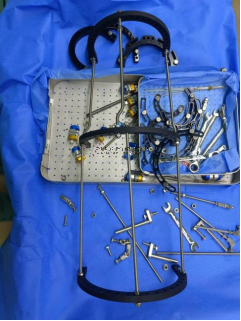 【最新病例】三臂十一轴机器人辅助器牵引——骨折外固定术骨折案例分享